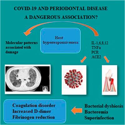 COVID-19 and Periodontitis: A Dangerous Association?